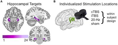 Effects of continuous versus intermittent theta-burst TMS on fMRI connectivity